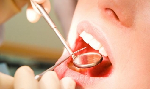 Петербургские стоматологи развеяли мифы о зубных имплантатах и имплантации