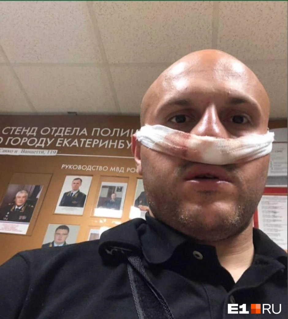 Заявлениям инвалида не дали хода, несмотря на явные признаки нападения | Источник: читатель E1.RU