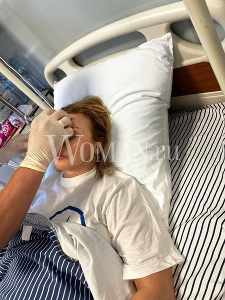 Первые фото Лады Дэнс из больницы: голова разбита, порезы на щеке
