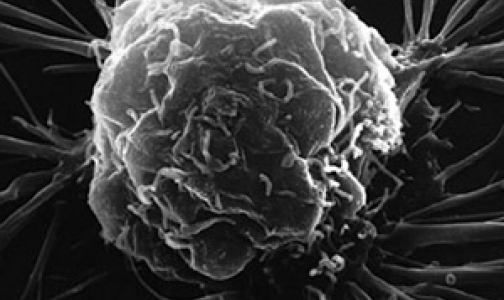 Петербургские ученые синтезировали вещество, уничтожающее раковые клетки