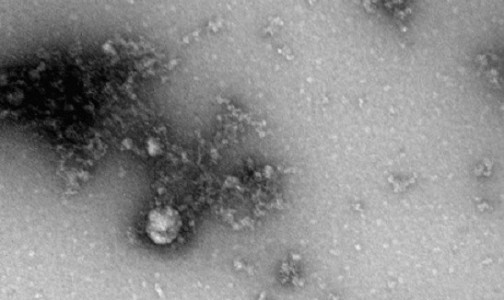 В России получили первое изображение «британского» штамма коронавируса