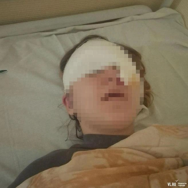 По одной из версий, девочка сама случайно ткнула себя в глаз после удара одноклассника | Источник: newsvlru / T.me