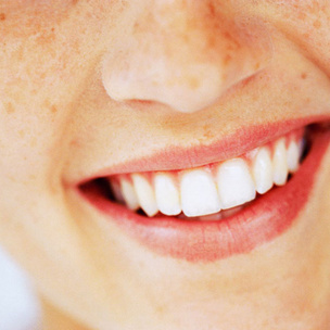 Все, что стоит знать об отбеливании зубов
