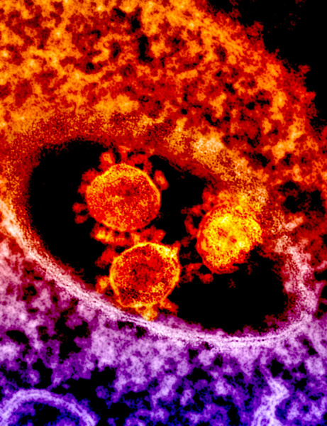 Еще заразнее: в Великобритании обнаружили новую мутацию коронавируса