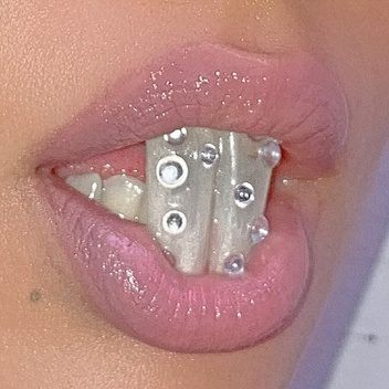 Стоматолог Рыжова рассказала о моде на наращивание беличьих зубов с сережками и стразами