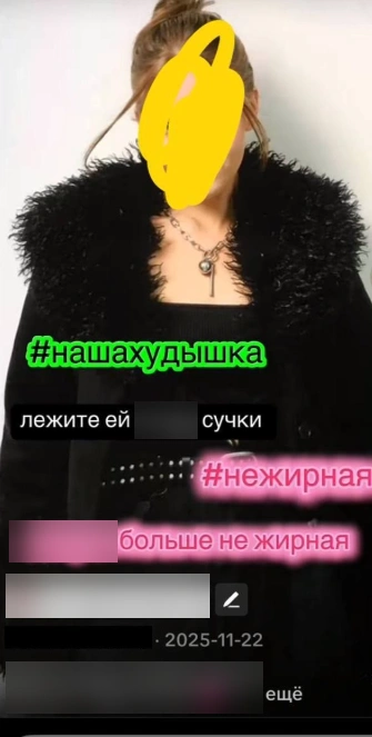 На нервной почве Алина скинула 35 килограммов, но и это вызвало насмешки в «фан-аккаунте» | Источник: соцсети