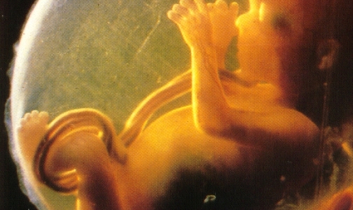 Материнская смертность: каждая пятая женщина умирает от аборта