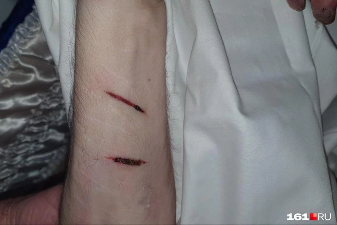 В гробу Дмитрий Бакшеев лежал со вскрытыми венами | Источник: Алексей Аванесян