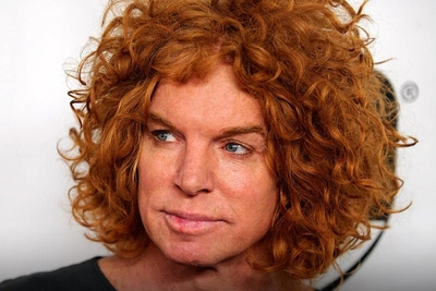 Carrot Top очнулся и дышит самостоятельно