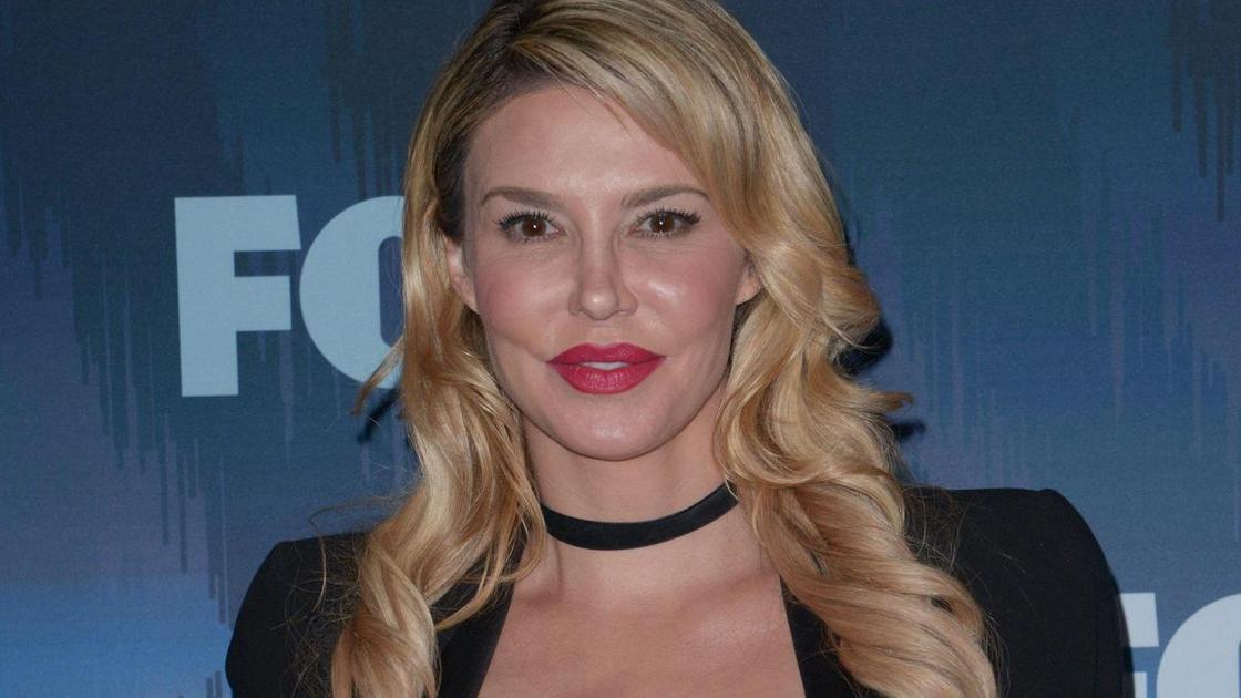 Лопнувший грудной имплант изуродовал лицо модели Брэнди Глэнвилл&nbsp;&mdash; &laquo;оплавилась&raquo; кожа