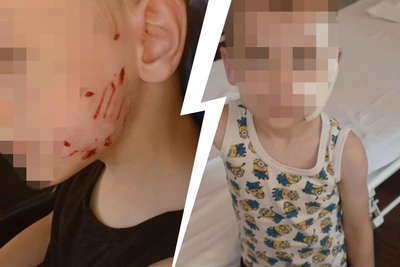 Под Волгоградом собака покусала пятилетнего мальчика