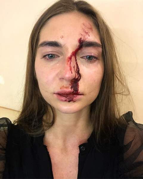 Девушке разбили в кровь лицо и отобрали телефон во время похода в салон красоты