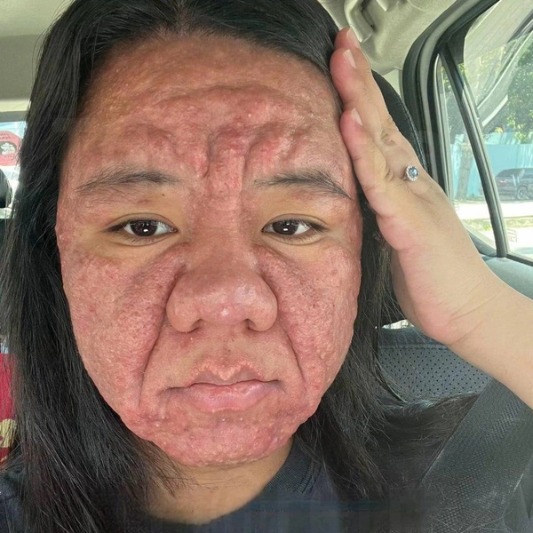 Так девушка выглядела во время беременности и после родов | Источник: Oddity Central