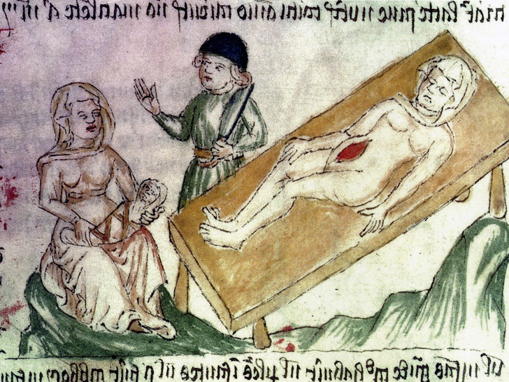 Фото №3 - Страшнее чумы: как принимали роды в Средневековье