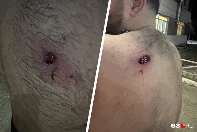 «В этом парне были дырки в сантиметр!» — говорят очевидцы | Источник: читатель 63.RU 