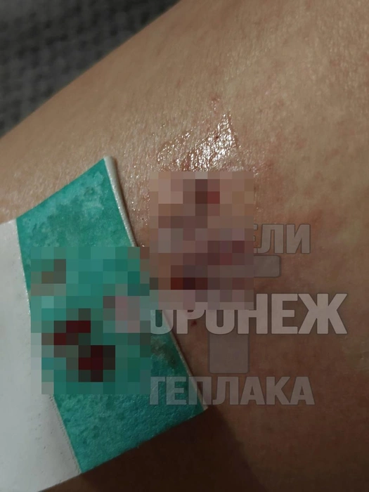 Последствия нападения | Источник: «Жители Теплака (Воронеж) Тепличный Тенистый» / T.me