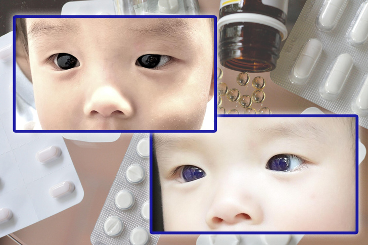 У 6-месячного ребенка в больнице изменился цвет глаз. Вот как врачи это объяснили
