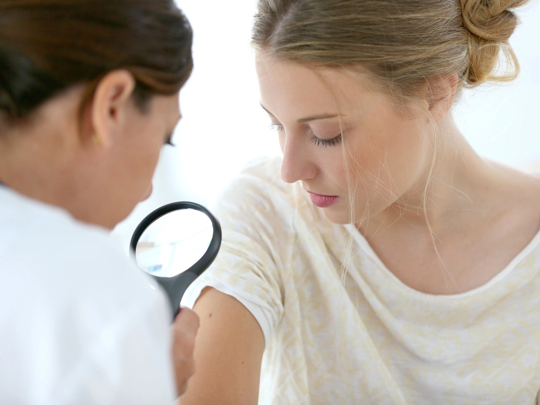 Неочевидный симптом наступающего рака кожи, который вы можете не заметить | marieclaire.ru