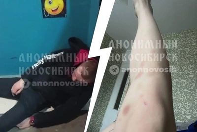 Подростки избили посетителей бара на Золотой Ниве до полусмерти