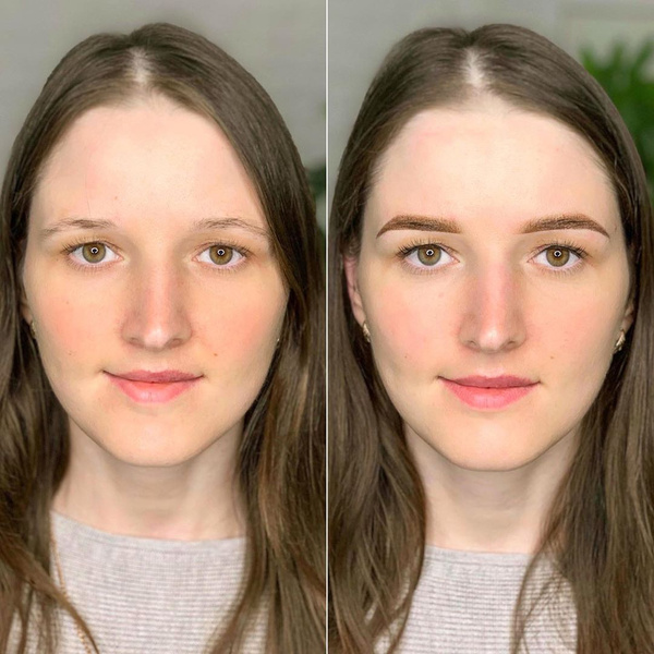 Как меняется лицо с возрастом фото
