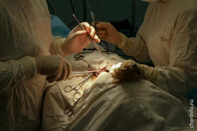 В Череповце впервые провели ревизионную пластику связки колена