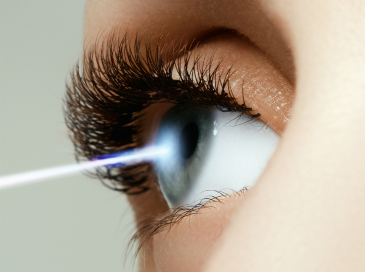 10 мифов и фактов о лазерной коррекции зрения