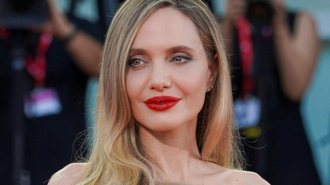 Что на самом деле произошло с лицом Анджелины Джоли: версии врачей