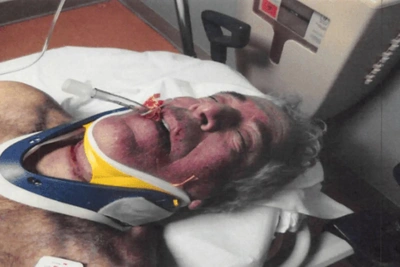 Врач объяснил вердикт о самоубийстве Эпштейна