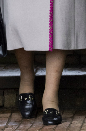 Фото №6 - Почему ноги герцогини Меган вызывают особый интерес