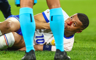 Капитан сборной Франции по футболу сломал нос в матче с Австрией