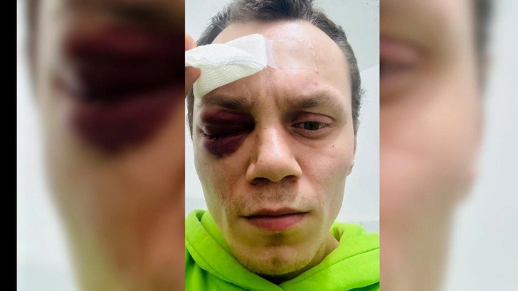 Врачи пытались сохранить глаз, хотя понимали — функционировать он не будет