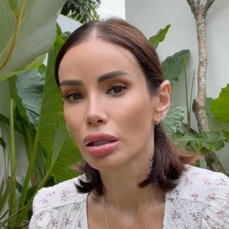 41-летняя Айза показала результат пластики лица — фото до и после