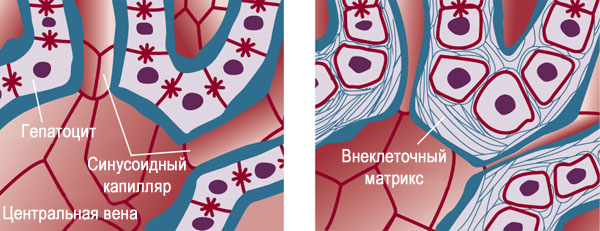 Цирроз в крысиной клетке