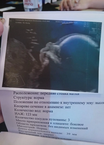 Анастасия с нетерпением ждала появления сына на свет