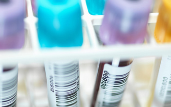 Ученые впервые «очистили» ДНК от ВИЧ