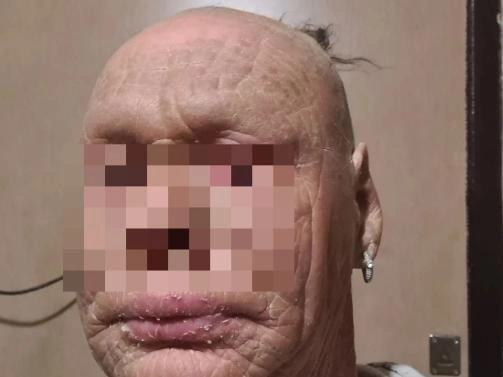 Надежда живёт с этим диагнозом с самого детства. | Источник: читатель E1.RU