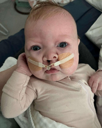 Как выглядит малышка с одним из самых редких генетических заболеваний в мире 