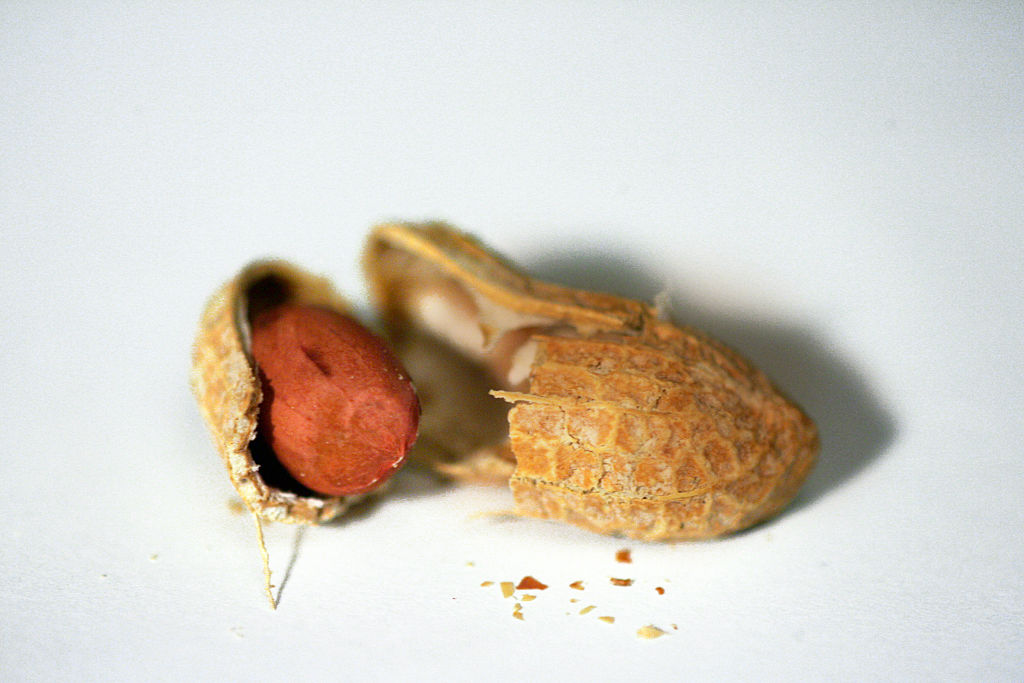 Жареный арахис вред. Вредители на жареном арахисе. Alergiya Iza oraxisa.