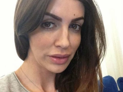 «Осталось чуть-чуть»: Алиса Казьмина готовится к срочной операции по коррекции провалившегося носа