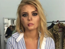 Анна Шульгина шокировала поклонников внешним видом