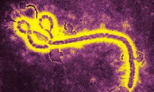 Минздрав: надо быть готовыми к завозу в страну лихорадки Эбола