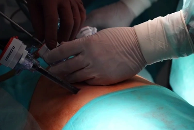 Иркутские хирурги провели ребенку две операции одновременно