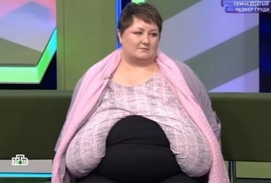 «Во сне грудь лежит рядом с головой, может задушить меня»: россиянка боится умереть из-за 17-го размера груди
