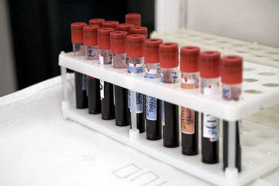 Как стать донором крови в Архангельской области