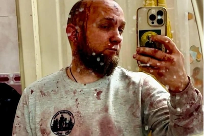 Общественник рассказал о драке с журналистами