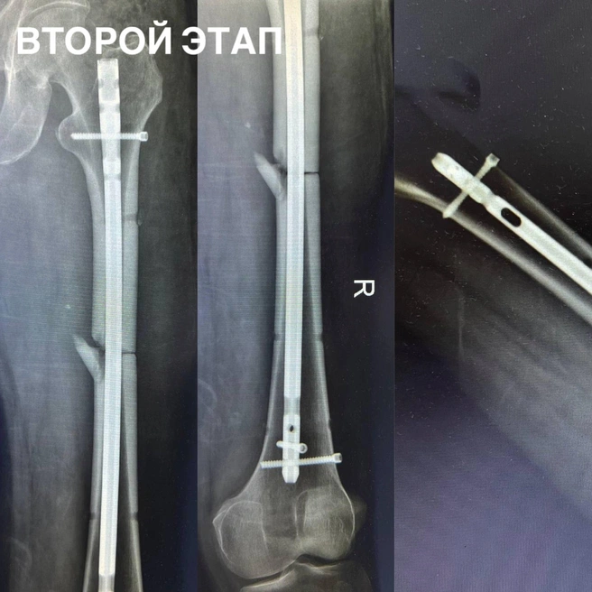 Снимок рентген | Источник: Минздрав Ставропольского края