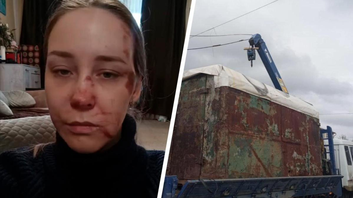 «Летальный исход был вероятен». Челябинка показала, как пострадало ее лицо от удара трамвайных проводов 