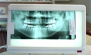 Зубная боль: пульпит или периодонтит?