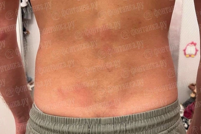 Percussionist of Mikhailovsky Theatre injured in restaurant fight