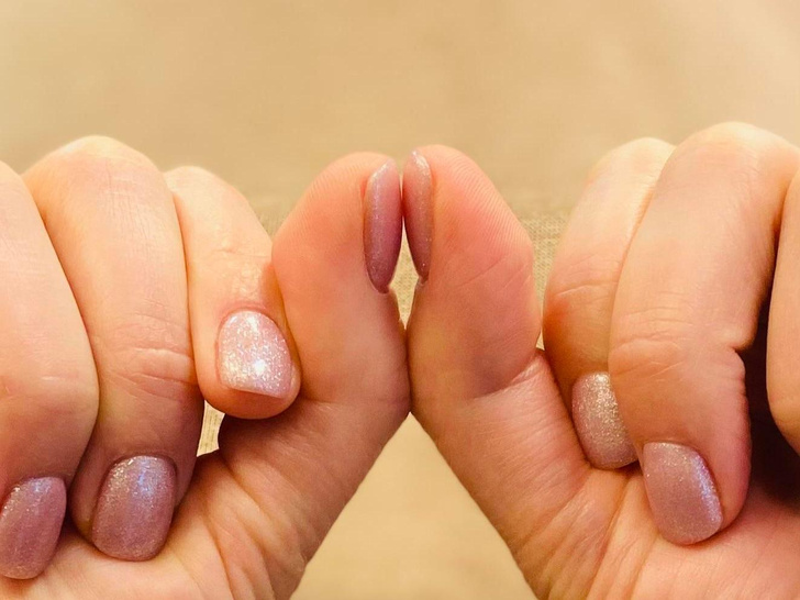 Быстрый тест: посмотрите на большие пальцы, чтобы узнать о здоровье сердца и легких